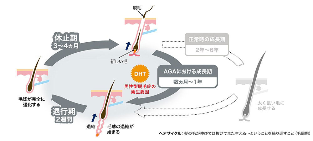 ヘアサイクル