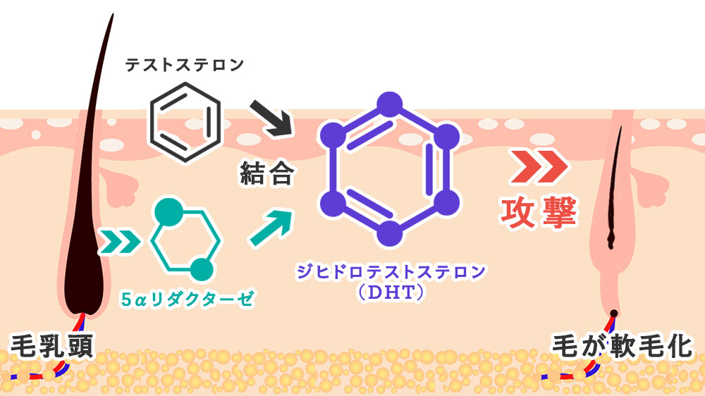 ジヒドロテストステロン（DHT）の生成