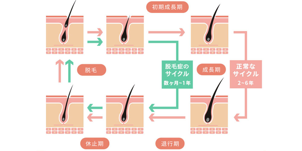 ヘアサイクル