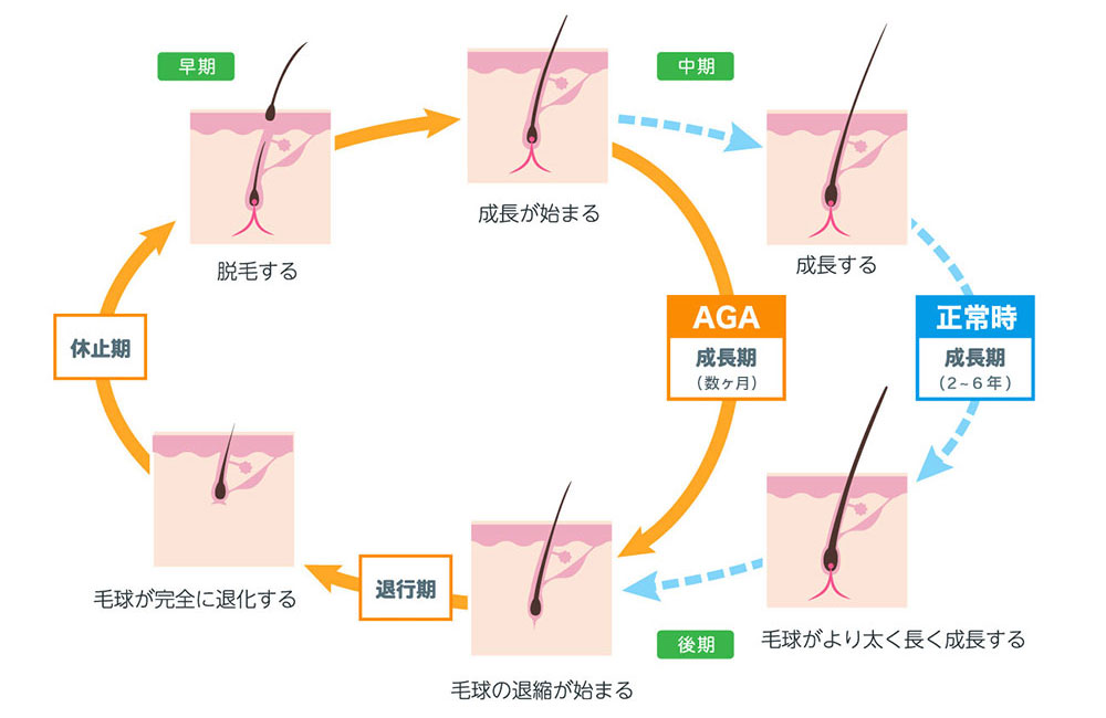 ヘアサイクル