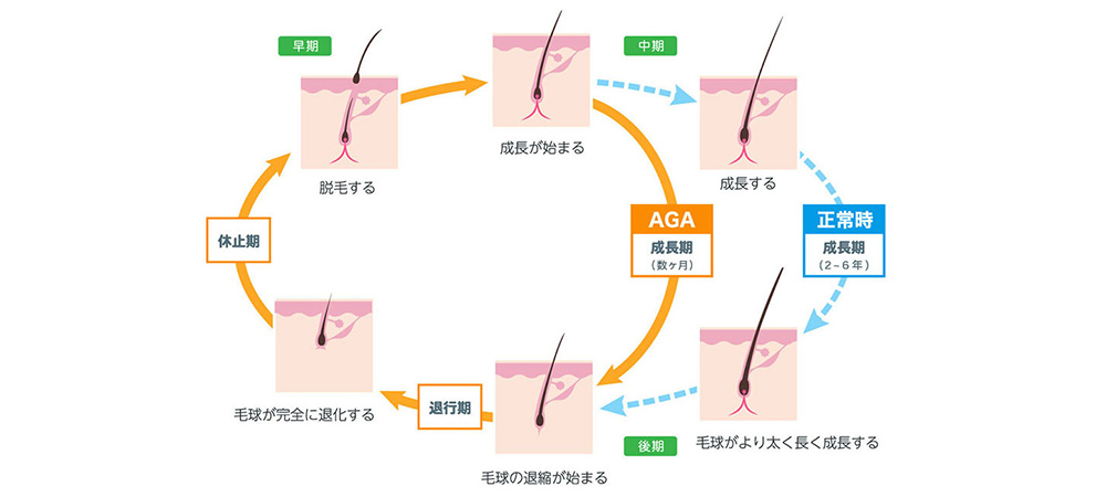 ヘアサイクル