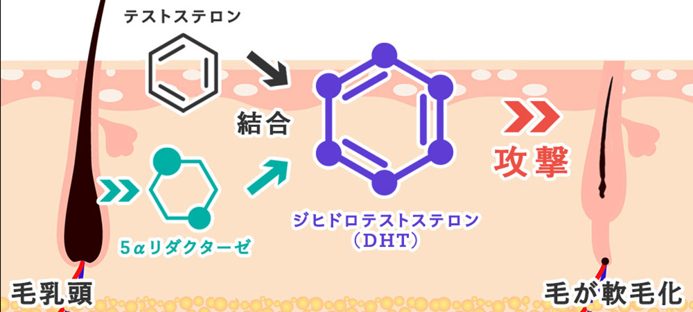 メカニズム